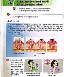 Giải SGK Khoa học lớp 5 Kết nối tri thức Chủ đề 4 Bài 20 Vi khuẩn gây bệnh ở người và cách phòng tránh (trang 72-74)
