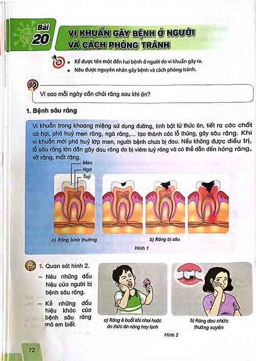 Giải SGK Khoa học lớp 5 Kết nối tri thức Chủ đề 4 Bài 20 Vi khuẩn gây bệnh ở người và cách phòng tránh (trang 72-74)